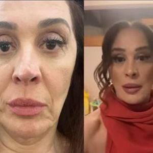 Claudia Raia mostrou o antes e depois de seu rosto após os procedimentos estéticos