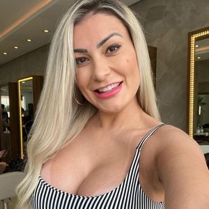 Andressa Urach revelou que ficará os próximos 7 dias sem gravar vídeos pornôs devido ao procedimento