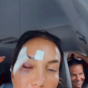 Ivete Sangalo foi diagnosticada com uma condição chamada síndrome vasovagal, que pode causar desmaios