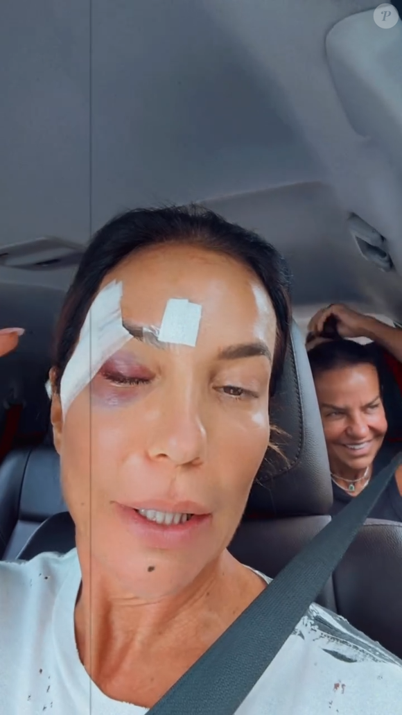 Ivete Sangalo foi diagnosticada com uma condição chamada síndrome vasovagal, que pode causar desmaios