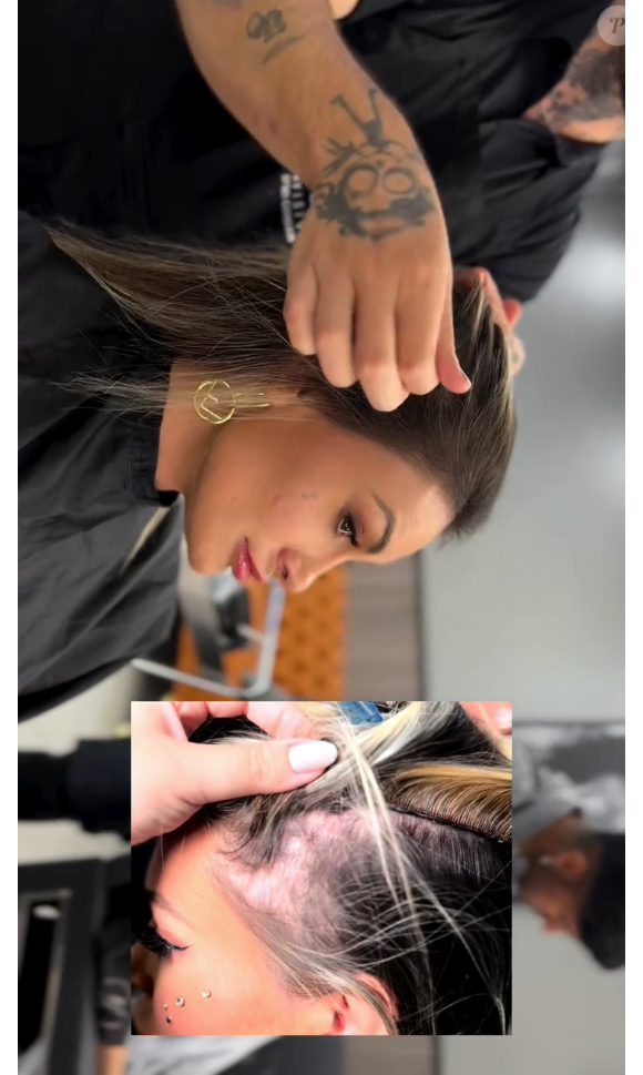 Andressa Urach estava com falhas nas laterais dos cabelos por causa da colocação do mega hair antigo