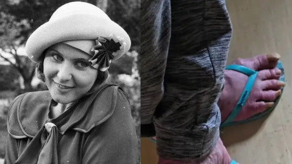 Saiba o destino de Rejane Schumann, ex-atriz da Globo encontrada sem água e sem banho há meses