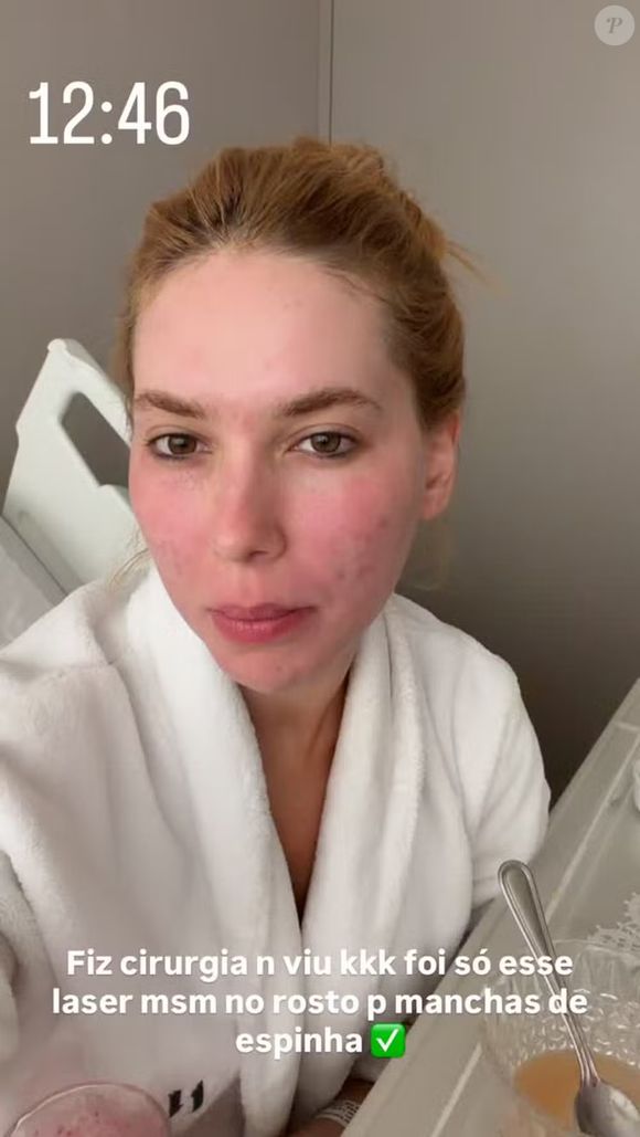 Nesta emana, Virgínia passou por um tratamento estético para amenizar as cicatrizes de acne da pele