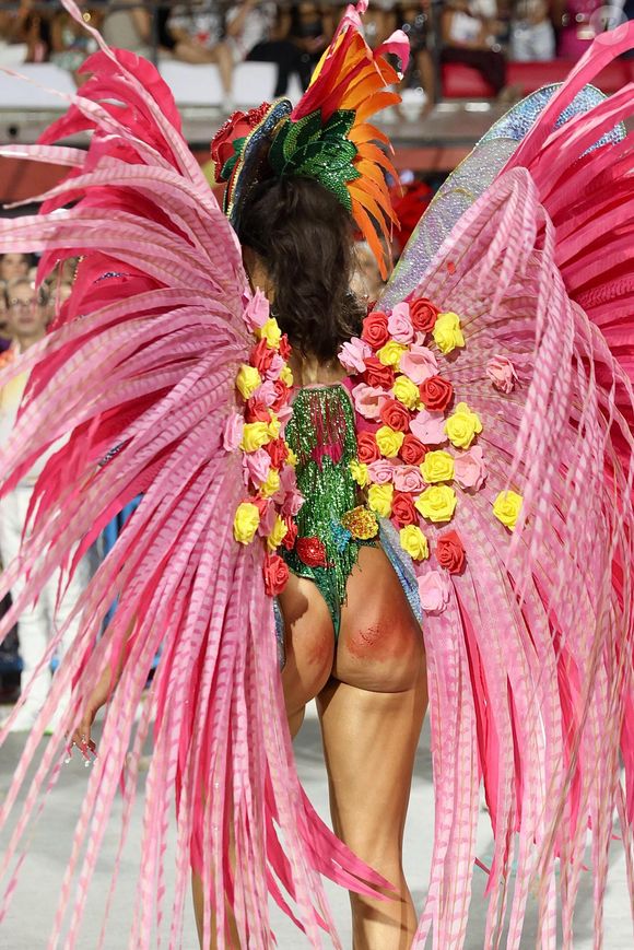 Alane Dias machucou o bumbum e ficou com ele ralado devido a sua fantasia no Carnaval 2025.