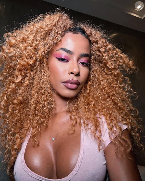 Depois dos preenchimentos no rosto, Lorena Maria ficou ainda mais linda