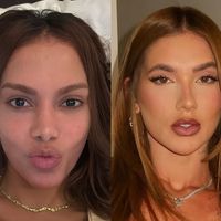 Antes e depois de Anitta, Virgínia Fonseca e mais: estes 22 famosos 'trocaram de rosto' com procedimentos estéticos