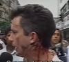Celso Russomano relatou agressão durante reportagem no 'Aqui Agora' em 1993