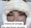 Andressa Urach confessou que ama cirurgias plásticas