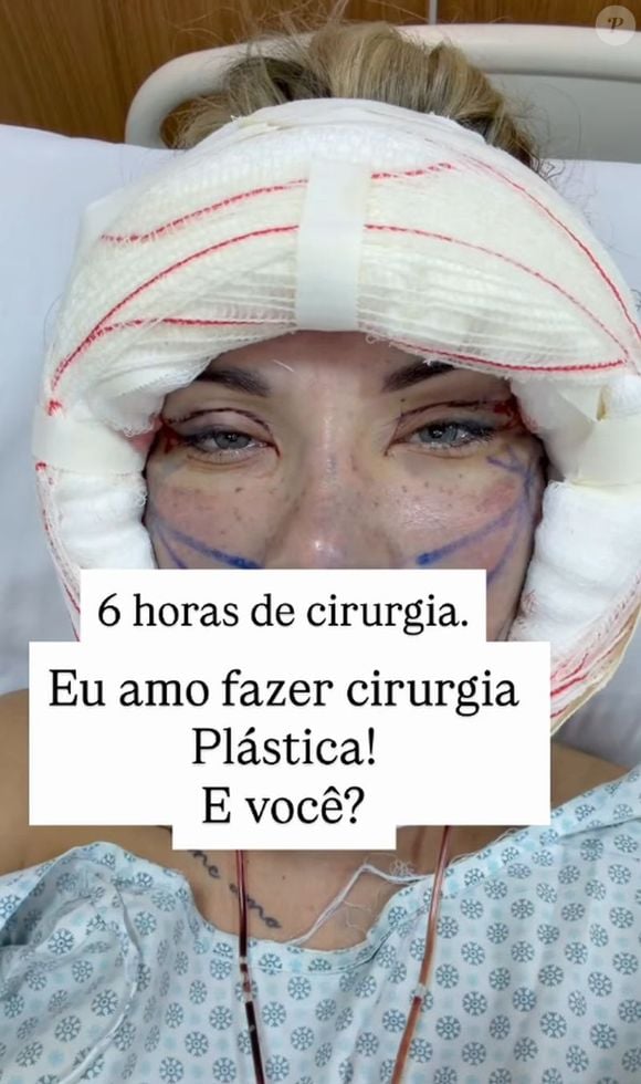 Andressa Urach confessou que ama cirurgias plásticas