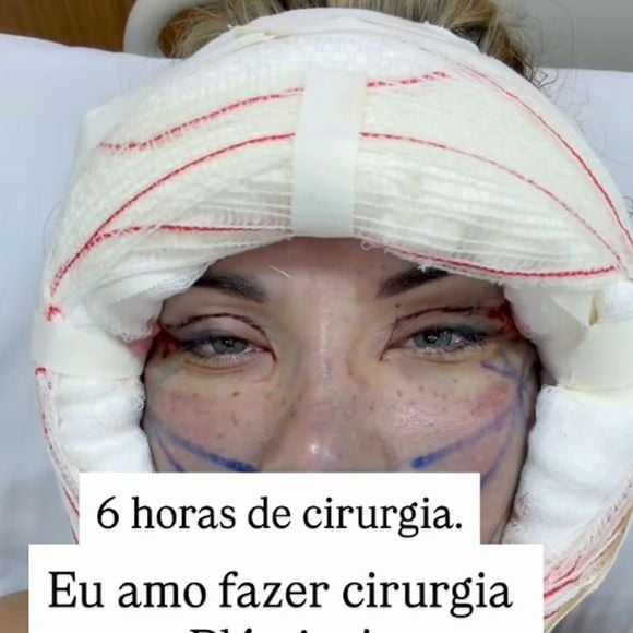 Andressa Urach confessou que ama cirurgias plásticas