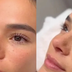 Faço microblading há dois anos e estou encantada, porque já quase nem me lembro mais de depilar as sobrancelhas