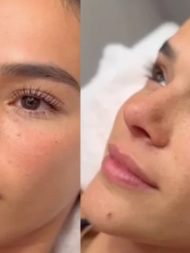 Faço microblading há dois anos e estou encantada, porque já quase nem me lembro mais de depilar as sobrancelhas