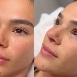 Faço microblading há dois anos e estou encantada, porque já quase nem me lembro mais de depilar as sobrancelhas