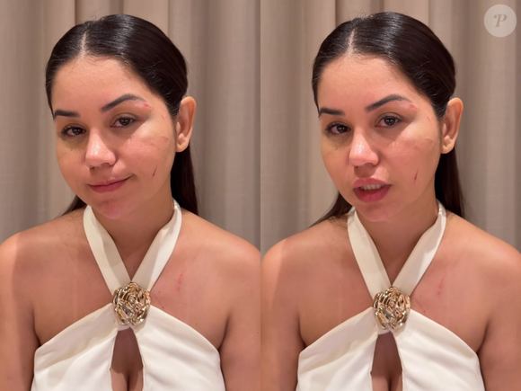 Antes da violência física, segundo Lays, ela já vinha recebendo mensagens intimidadoras que se tornaram recorrentes, principalmente quando expõe conquistas pessoais ou profissionais.