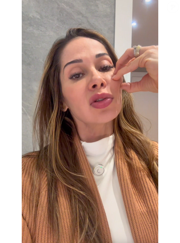 Maíra Cardi revelou ter colocado o PMMA há 20 anos e disse que não irá revelar o nome da profissional que o aplicou em seu rosto