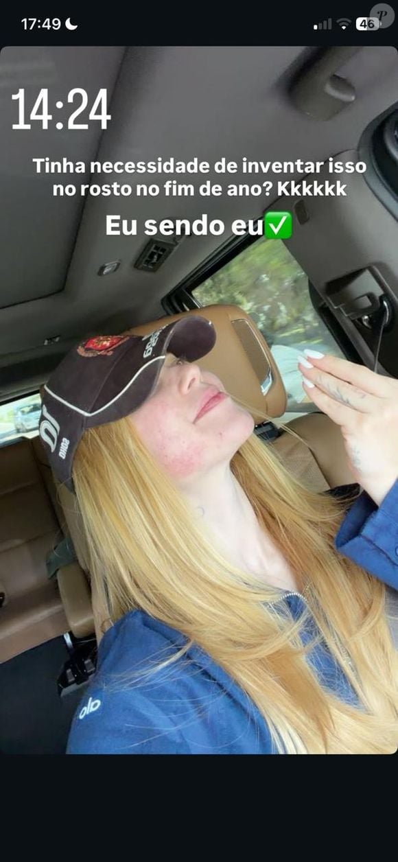 'Tinha necessidade?': Virgínia Fonseca brinca com arrependimento após procedimento estético e surge com rosto sensível às vésperas das festas de fim de ano