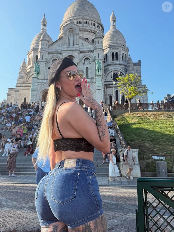 Andressa Urach fez a cirurgia para mudar a cor do olho na França