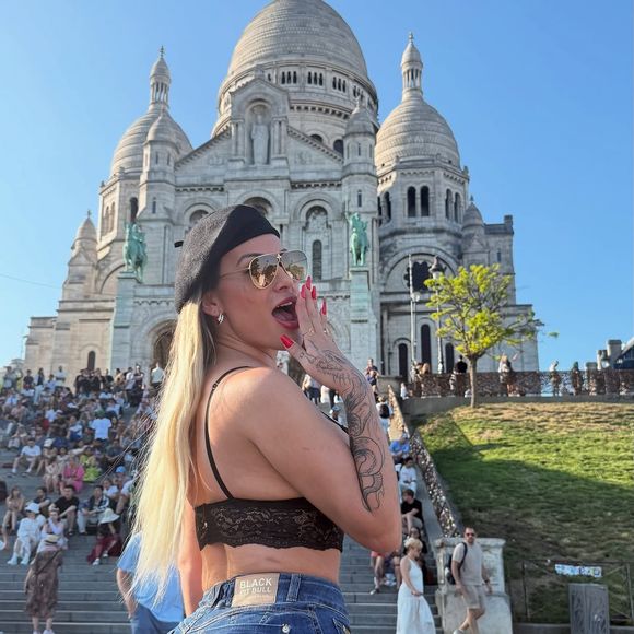 Andressa Urach fez a cirurgia para mudar a cor do olho na França