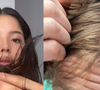 Por que não lavar o cabelo virou tendência no TikTok? Trend sobrecarrega o cabelo com sebo e poluição, alerta médica: 'Coceira frequente'