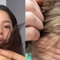 Por que não lavar o cabelo virou tendência no TikTok? Trend sobrecarrega o cabelo com sebo e poluição, alerta médica: 'Coceira frequente'