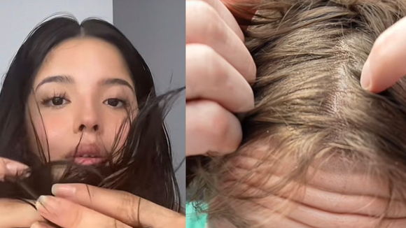 Por que não lavar o cabelo virou tendência no TikTok? Trend sobrecarrega o cabelo com sebo e poluição, alerta médica: 'Coceira frequente'