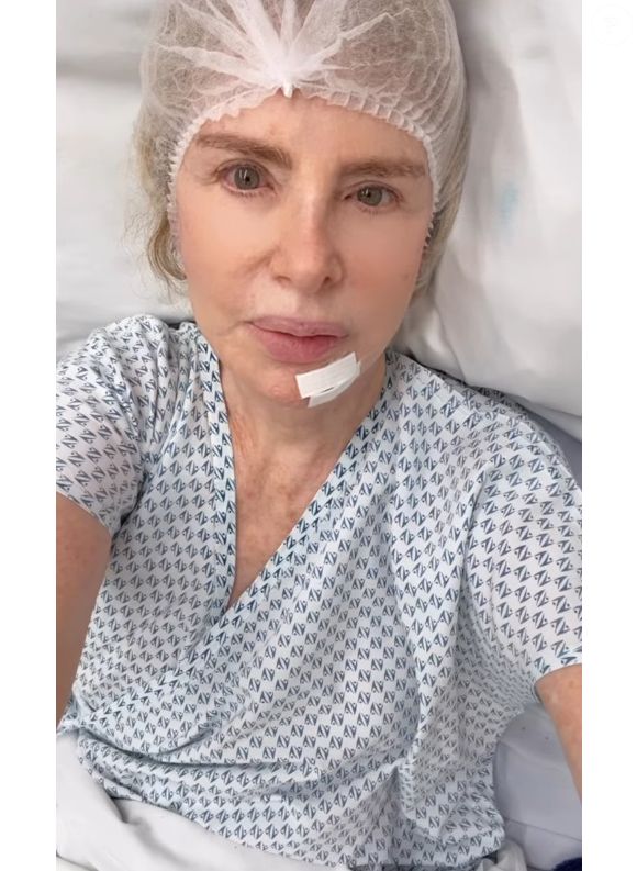 Ísis de Oliveira foi operada por conta de câncer de pele em 8 de março de 2025