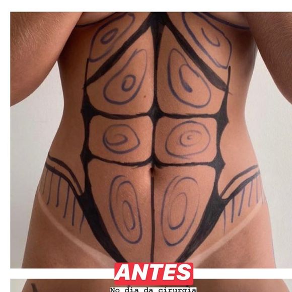 Gabriela Versiani mostra o corpo com marcações pré-lipo LAD na quarentena