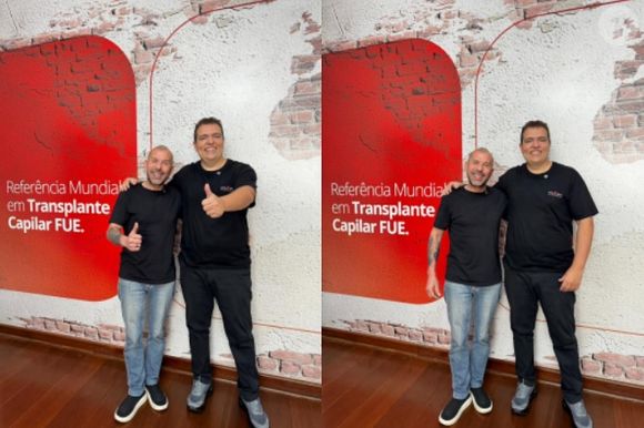 Rafael Ilha transplantou mais de 12 mil fios de cabelo após diagnóstico de calvície em grau 7. Nas fotos, cantor com o dr. João Gabriel Nunes, responsável pelo procedimento