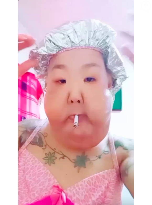 Juju do Pix chegou a arrecadar R$ 20 mil em uma vaquinha para a retirada do óleo mineral do rosto