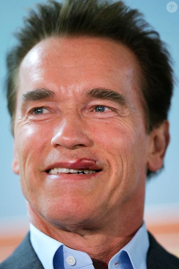 Nesta foto rara, Arnold Schwarzenegger aparece com os lábios machucados, o que gerou muito burburinho