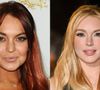 Antes e depois de Lindsay Lohan fez a web apostar em uma possível cirurgia de lifting facial