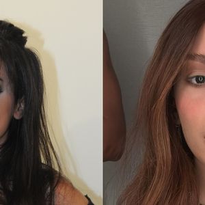 Antes e depois de Anitta: cantora já fez mais de 50 procedimentos estéticos e a mais recente transformação está dando o que falar