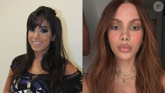 Antes e depois de Anitta: cantora já fez mais de 50 procedimentos estéticos e a mais recente transformação está dando o que falar