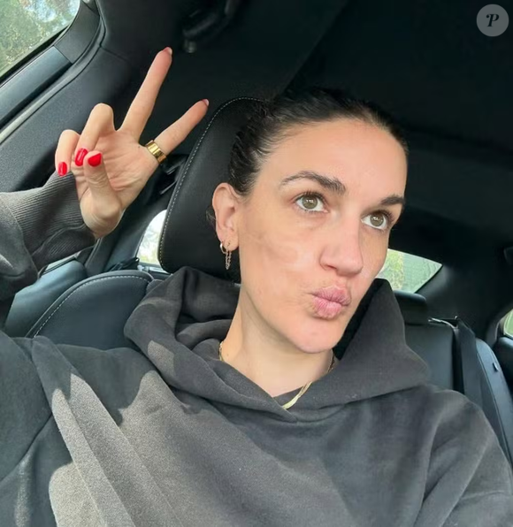 Segundo Victoria, o procedimento, que tinha como objetivo tratar a acne, resultou em queimaduras e cicatrizes graves