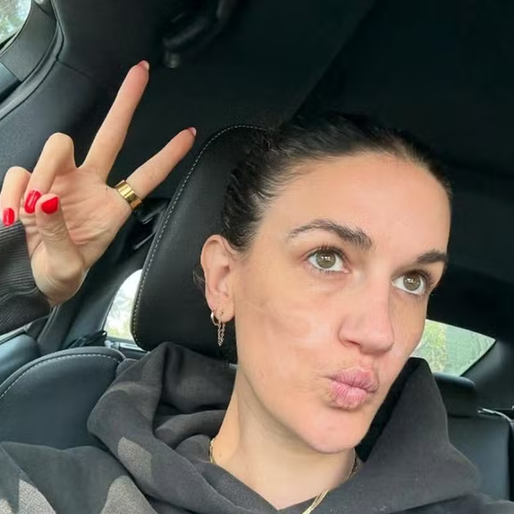 Segundo Victoria, o procedimento, que tinha como objetivo tratar a acne, resultou em queimaduras e cicatrizes graves