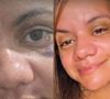Agredida pelo namorado com 61 socos no elevador de seu prédio, Juliana Soares mostrou o resultado da cirurgia reparadora