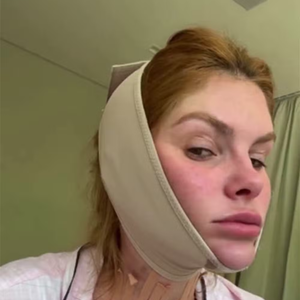 A influenciadora revelou que o desconforto com a papada não é recente e que o uso das faixas é mais uma tentativa para se sentir melhor com o espelho.