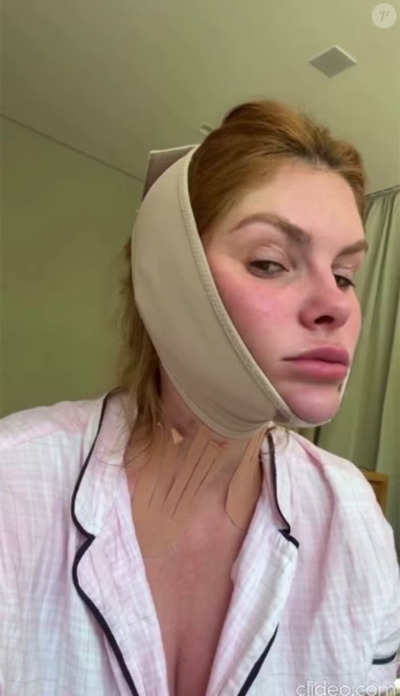 A influenciadora revelou que o desconforto com a papada não é recente e que o uso das faixas é mais uma tentativa para se sentir melhor com o espelho.