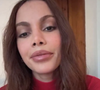 Rostos mais firmes, contornos mais definidos e pele com viço natural: a nova geração de celebridades está reaparecendo com feições rejuvenescidas e não necessariamente por cirurgias plásticas isoladas