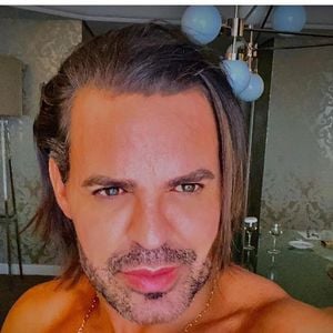 Então, procedimentos foram feitos para reconstruir o rosto de Eduardo Costa