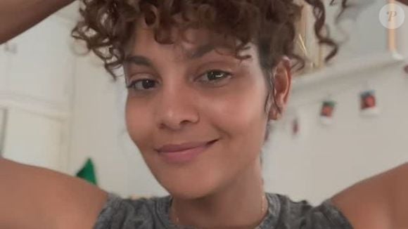 Lipedema de Bárbara Reis pode causar dor, inchaço e sensibilidade ao toque