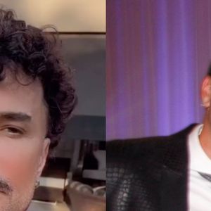 Antes e depois de Latino é impressionante. Veja como o cantor mudou com o tempo e procedimentos!