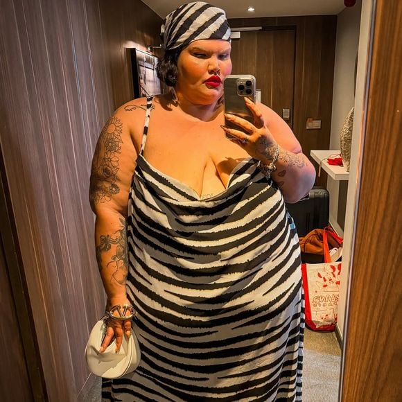 Thais Carla já emagreceu 75 kg desde a cirurgia bariátrica e tem impressionado com seu antes e depois