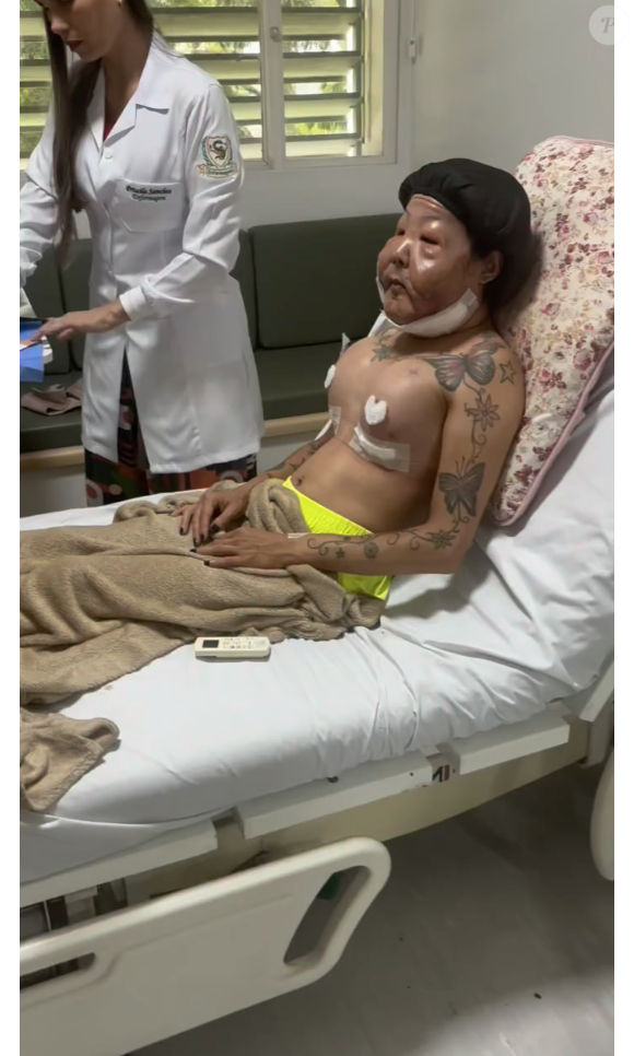 Agora, 4 meses depois da primeira cirurgia, Juju do Pix passou por um procedimento para implante de silicone em seus seios