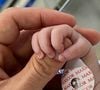 Aurora nasceu em 24 de setembro e, no dia 1º de outubro, Marcelo Zagonel revelou que a filha tinha passado por uma cirurgia