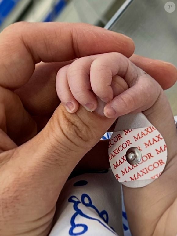 Aurora nasceu em 24 de setembro e, no dia 1º de outubro, Marcelo Zagonel revelou que a filha tinha passado por uma cirurgia