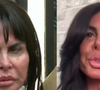 Antes e depois Gretchen: famosa exibe novo rosto após retirar preenchedores e estimular colágeno; cirurgiã plástica explica tratamentos