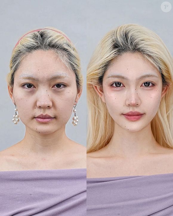 Nos comentários, seguidores de Dr. Lifeng ficam impressionados por suas transformações