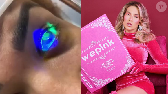 Mulher alega cegueira temporária após usar produto da WePink (11 de julho): A cabeleireira Lidiane Herculano teve as córneas queimadas após usar o produto Wedrop