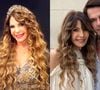 Elba Ramalho antes e depois: veja em 30 fotos a transformação radical da cantora, viralizada na web por rejuvenescimento